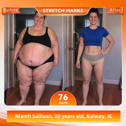 𝐎𝐟𝐟𝐢𝐜𝐢𝐚𝐥 𝐁𝐫𝐚𝐧𝐝 𝐒𝐭𝐨𝐫𝐞 🇮🇪| 𝐀𝐊𝐘𝐆𝐎® 𝟐𝟎𝟐𝟔 𝐌𝐨𝐫𝐢𝐧𝐠𝐚 x 𝐁𝐞𝐫𝐛𝐞𝐫𝐢𝐧𝐞 x 𝐍𝐀𝐃+ 𝟔-𝐈𝐧-𝟏 𝐌𝐢𝐜𝐫𝐨-𝐏𝐚𝐫𝐭𝐢𝐜𝐥𝐞 𝐒𝐜𝐮𝐥𝐩𝐭𝐢𝐧𝐠 & 𝐅𝐚𝐭-𝐁𝐮𝐫𝐧 𝐒𝐡𝐨𝐫𝐭𝐬 (Women + Men with Enhanced Male Vitality Blend💪)
