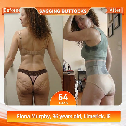 𝐎𝐟𝐟𝐢𝐜𝐢𝐚𝐥 𝐁𝐫𝐚𝐧𝐝 𝐒𝐭𝐨𝐫𝐞 🇮🇪| 𝐀𝐊𝐘𝐆𝐎® 𝟐𝟎𝟐𝟔 𝐌𝐨𝐫𝐢𝐧𝐠𝐚 x 𝐁𝐞𝐫𝐛𝐞𝐫𝐢𝐧𝐞 x 𝐍𝐀𝐃+ 𝟔-𝐈𝐧-𝟏 𝐌𝐢𝐜𝐫𝐨-𝐏𝐚𝐫𝐭𝐢𝐜𝐥𝐞 𝐒𝐜𝐮𝐥𝐩𝐭𝐢𝐧𝐠 & 𝐅𝐚𝐭-𝐁𝐮𝐫𝐧 𝐒𝐡𝐨𝐫𝐭𝐬 (Women + Men with Enhanced Male Vitality Blend💪)
